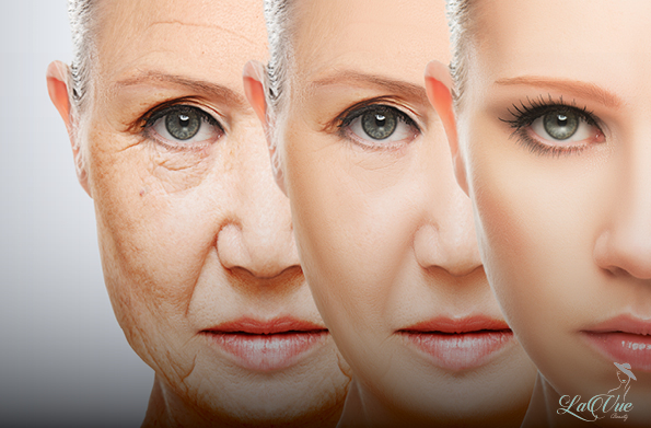Gesicht komplett (Microneedling)