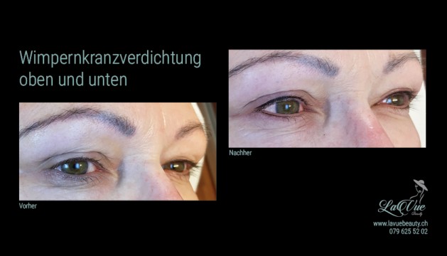 Wimpernkranzverdichtung oben und unten Vorher Nachher Bild MICRONEEDLING PERMANENT MAKE UP MICROBLADING THUN BERN