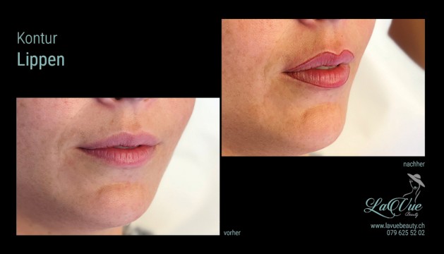 Lippen Kontur mit Schattierung Vorher Nachher Bild MiCRONEEDLING PERMANENT MAKE UP MICROBLADING THUN BERN