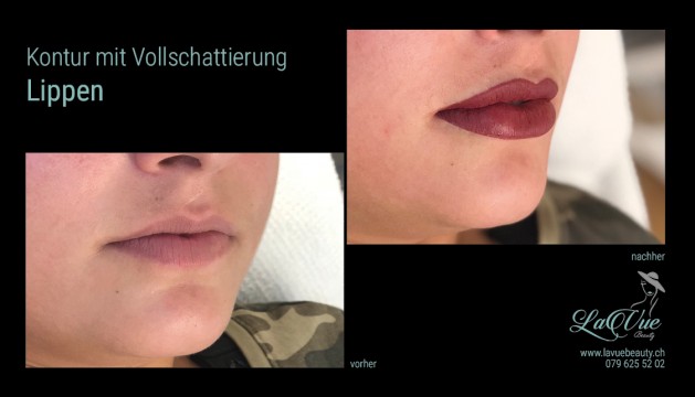 Lippen Kontur mit Schattierung Vorher Nachher Bild MICRONEEDLING PERMANENT MAKE UP MICROBLADING THUN BERN
