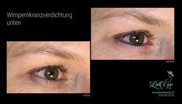 Wimpernkranzverdichtung oben und unten Vorher Nachher Bild MICRONEEDLING PERMANENT MAKE UP MICROBLADING THUN BERN