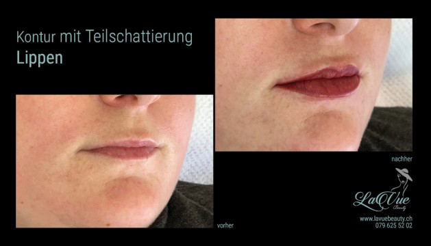 Lippen Kontur mit Schattierung Vorher Nachher Bild MICRONEEDLING PERMANENT MAKE UP MICROBLADING THUN BERN