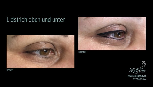 Lidstrich oben und unten Vorher Nachher Bild MICRONEEDLING PERMANENT MAKE UP MICROBLADING THUN BERN