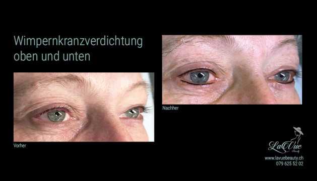 Wimpernkranzverdichtung oben und unten Vorher Nachher Bild MICRONEEDLING PERMANENT MAKE UP MICROBLADING THUN BERN