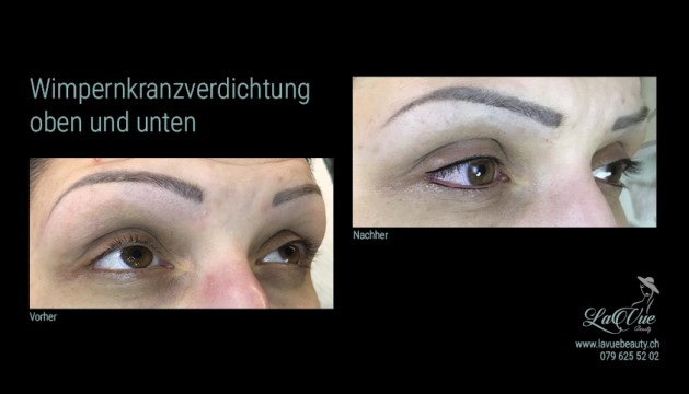 Wimpernkranzverdichtung oben und unten Vorher Nachher Bild MICRONEEDLING PERMANENT MAKE UP MICROBLADING THUN BERN